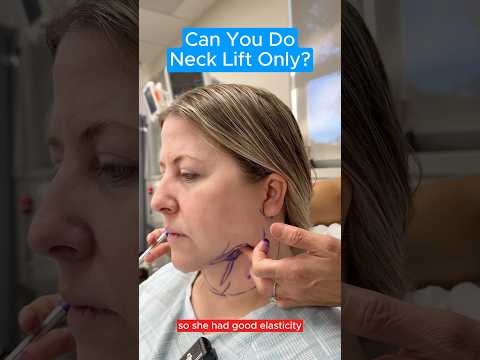 Can You Do Neck Lift Only? #facelift