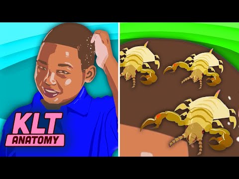 Why Do I Have Head Lice?! | KLT Anatomy