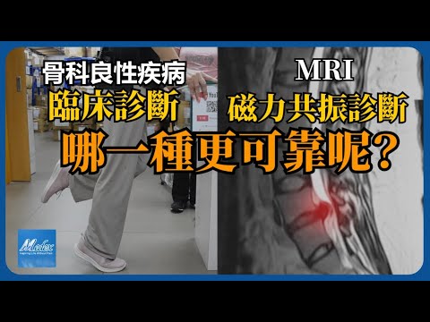 【骨科良性疾病臨床診斷與MRI診斷，哪一種更可靠呢？】