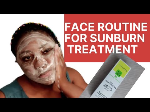 My Sunburn Treatment  face Routine|using products I bought from@Sephora  | Ojong Falone