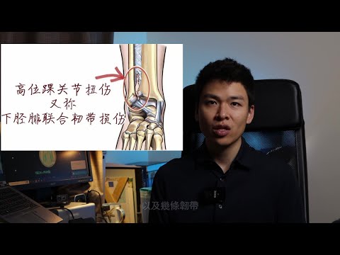 I 高位腳踝扭傷 I High ankle sprain I