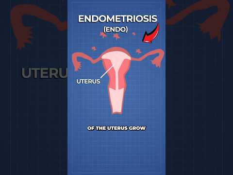 Scientists Create World's First Blood Test for Endometriosis