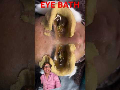 Ancient Eye Miracle !!