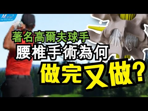 【自診自醫】著名高爾夫球手的腰椎手術為何做完又做?(B18a/B18b)(3D Animation)