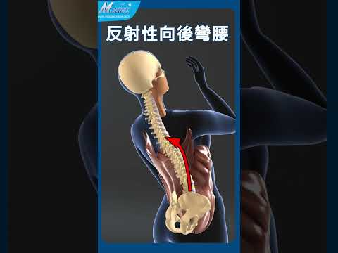 【自診自醫】打噴痴或咳嗽會腰腿麻痛?(B18b)(3D Animation)