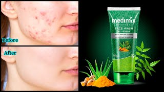 3 Days pimple reduction challenge /#Medimix anti pimple facewash