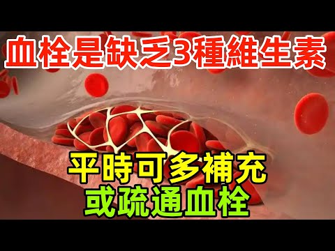 血栓是因為缺乏3種維生素？醫生忠告：平時可多補充，或疏通血栓