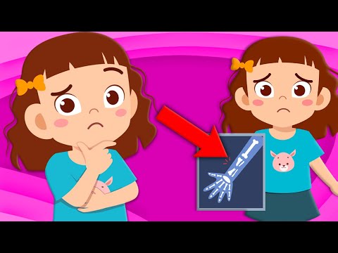 Learn How Broken Bones Heal! | Human Body Songs For Kids | KLT Anatomy