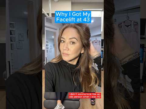 Why I Got My Facelift at 43 (Interview)