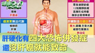 肝硬化有四大恐怖併發症 還沒肝癌就能致命 健康2.0