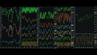 The 9th Wave Larger Cycles