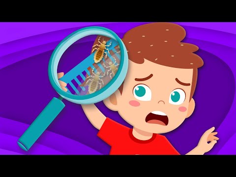 Learn About Lice & How To Get Rid Of Them!  | Human Body Song For Kids | KLT Anatomy