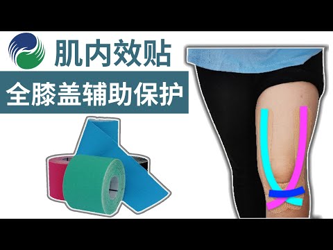 肌内效贴全膝盖辅助保护贴法 | Kinesiology Taping For Full Knee Support