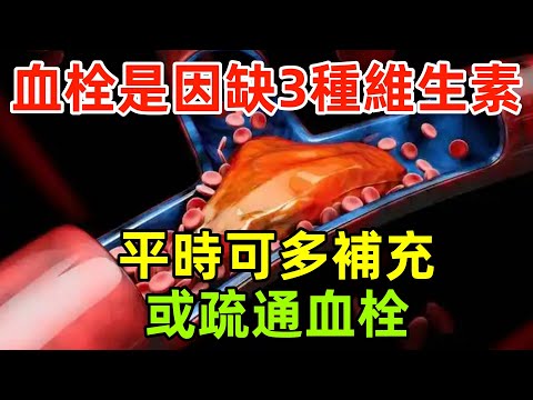 血栓是因為缺乏3種維生素？醫生忠告：平時可多補充，或疏通血栓