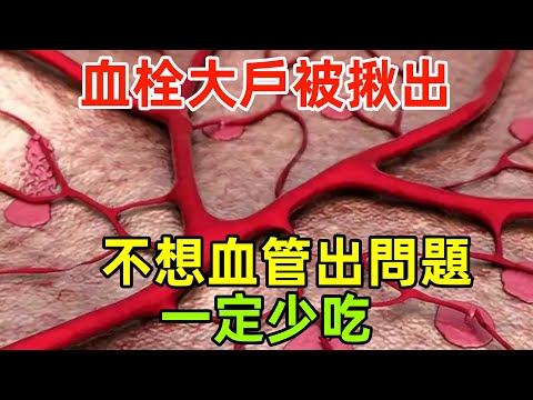 「血栓大戶」被揪出，肥肉十倍，提醒：不想血管出問題，一定少吃