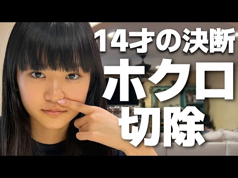 ことが鼻の下のあのホクロをとうとう取る‼痛みは？跡は？14歳で満を持して決断！