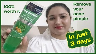 Medimix Ayurvedic Anti pimple Face Wash Review | Reduction Of Pimples In Just 3 Days 😱