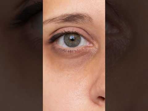 😱✅ Dark circles solution #darkcircles #dailyshorts #skincare #skincareroutine #puffyeyes