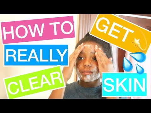 HOW TO REALLY GET RID OF ACNE IN ONE WEEK (ACTUALLY WORKS!)