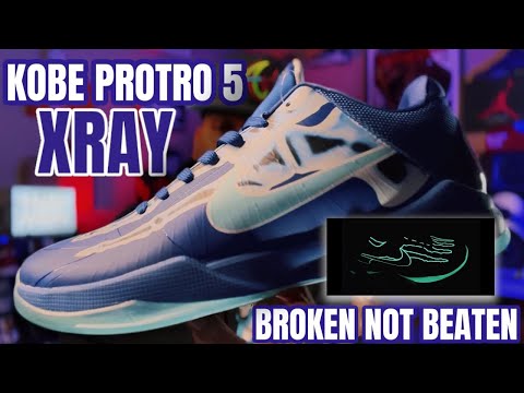 FIRST LOOK ! KOBE 5 PROTRO “X-RAY “ BROKEN BUT NOT BEATEN ( 3RD PARTY )