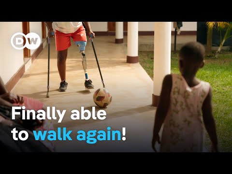 Uganda - Protheses for a new life | DW Documentary