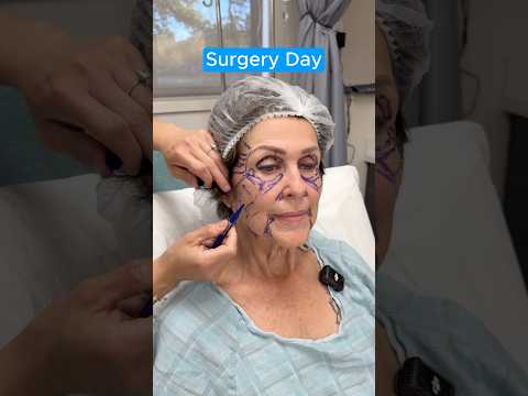 AMAZING FACELIFT TRANSFORMATION (Journey)