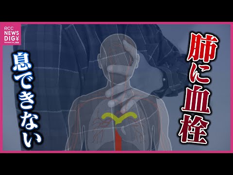 「症状が出た時はすでに遅い」避難生活でリスク高まる “エコノミー症候群”　車の渋滞や立ち往生などで発症も　メカニズムと日頃からできる対策は