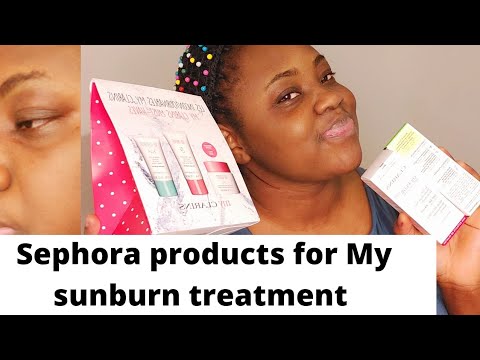 I got sunburn on my face + SEPHORA products to clear sunburn