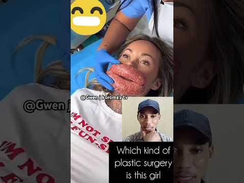 #plasticsurgery #surgery #shortvideo #shorts