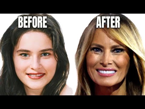 Šokantna Istina o Transformaciji Melanije Tramp: Da Li Je Sve Prirodno?