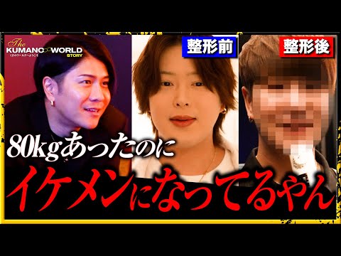 「整形してメイクも辞めました」DeZon大阪唯一の幹部であり絶対的なNo.1 ホストが人生初整形 その姿に社長くまの心も驚きを見せる