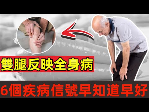 雙腿反映全身病，千萬要留心！腿上6個疾病信號，早知道早好