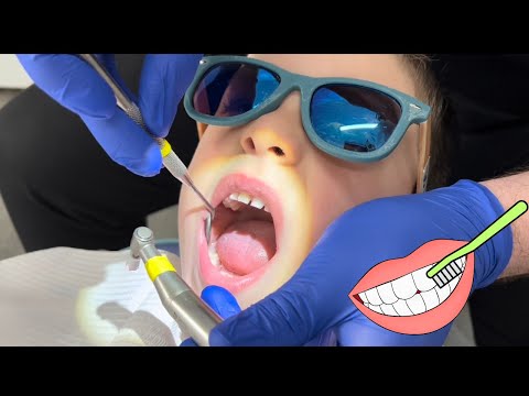 Oliver and Lucas Visit the Dentist 🦷 Dentist for Kids 🦷 Kids Fun Videos