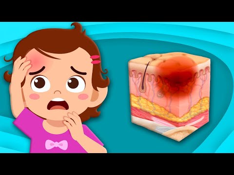 Discover How Bruises Happen! | Human Body Songs For Kids. | KLT Anatomy