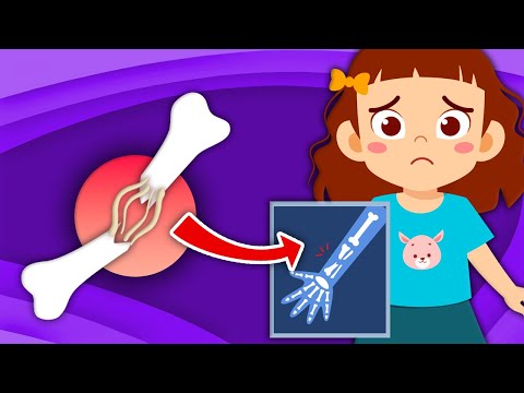 How Do Broken Bones Heal? | Human Body Songs For Kids | KLT Anatomy