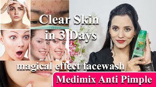 MEDIMIX PIMPLE REMOVING FACEWASH |MAGICAL EFFECT | GET CLEAR SKIN IN 3 DAYS | GLAM WTH UJALA