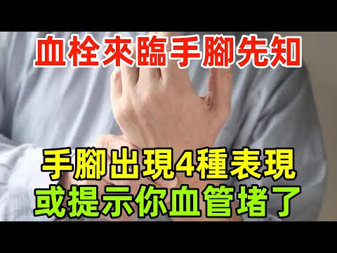 血栓來臨，手腳先知！醫生：手腳出現4種表現，或提示你血管堵了