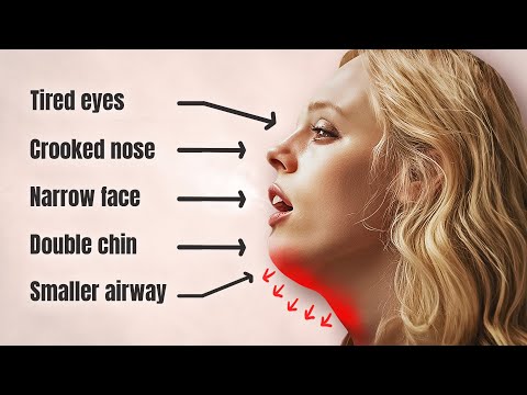 The Silent Epidemic Changing Your Facial Structure