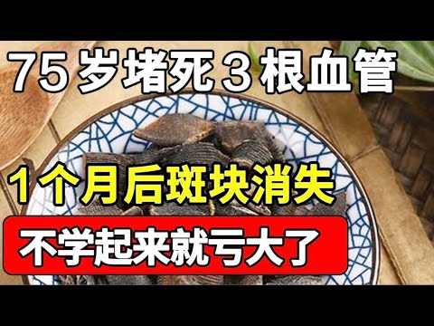 75岁堵死3根血管，老人坚持每天都吃这一物，不到1个月血管斑块、垃圾全没了，不学起来就亏大了！【本草养生大智慧】