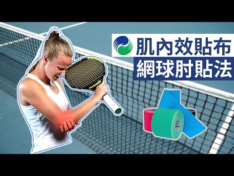 網球肘的肌內效貼貼法【肌貼】| Kinesiology Taping for Tennis Elbow