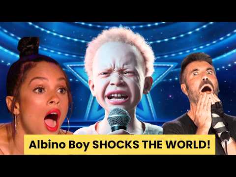 Albino Boy from Madagascar Stuns the World with his emotional angelic song (ai generated)