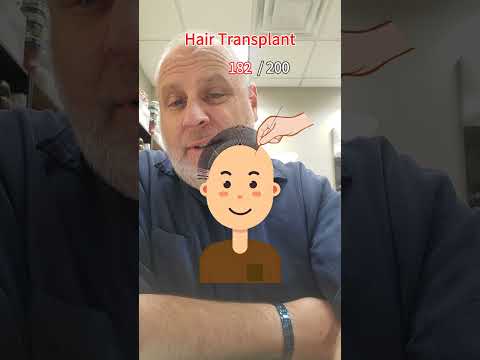 Hair transplant game