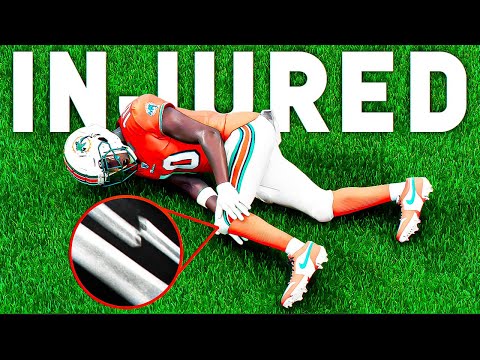 Tyreek Hill Horrible Injury In Playoffs.. Madden 25 Superstar Mode #32