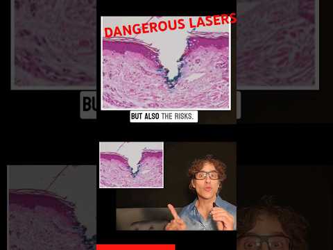 These Face Lasers Can Be Dangerous!!