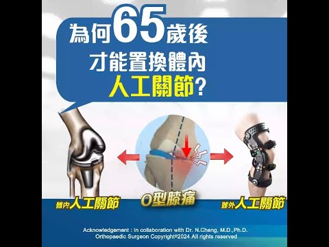 為何65歲後才置換人工关節?