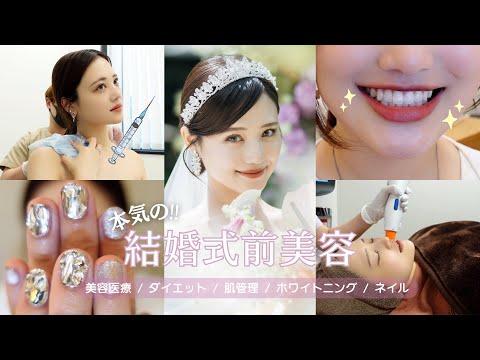 【本気の‼️結婚式前美容】効果絶大な美容医療、ダイエット、ホワイトニングなど🦷💉やって良かった施術総集編✨【プレ花嫁さん絶対見て👰🏻‍♀️💐】