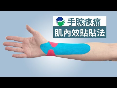 手腕疼痛的肌內效貼貼法 【肌貼】| Kinesiology Taping for Wrist Pain