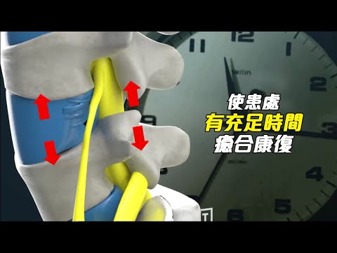 【自診自醫】非手術合併牽引有效解決腰腿麻痛(B18b)(3D Animation)