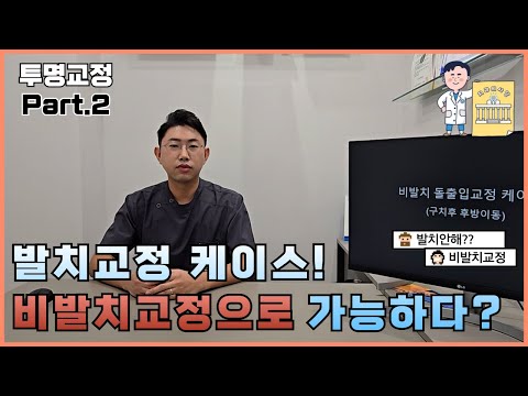 치과의사가 알려주는 투명교정장치? Part.2 발치케이스? 비발치교정으로