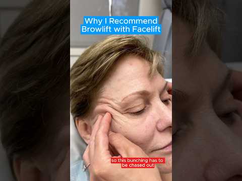 Why I Recommend Browlift with Facelift